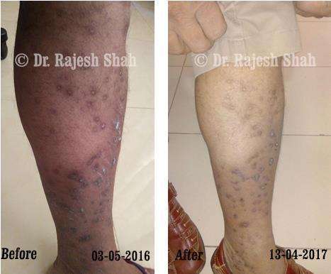lifeforce homeopathy case-photos